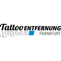 Tattooentfernung Frankfurt in Frankfurt am Main - Logo